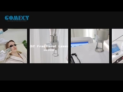 Φραγματικό λέιζερ διοξειδίου του άνθρακα Νέωση του δέρματος Σφίξιμο δέρματος