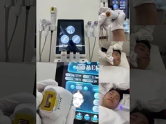 12d hifu + vmax + M8 + Ice Hammer 4 σε 1